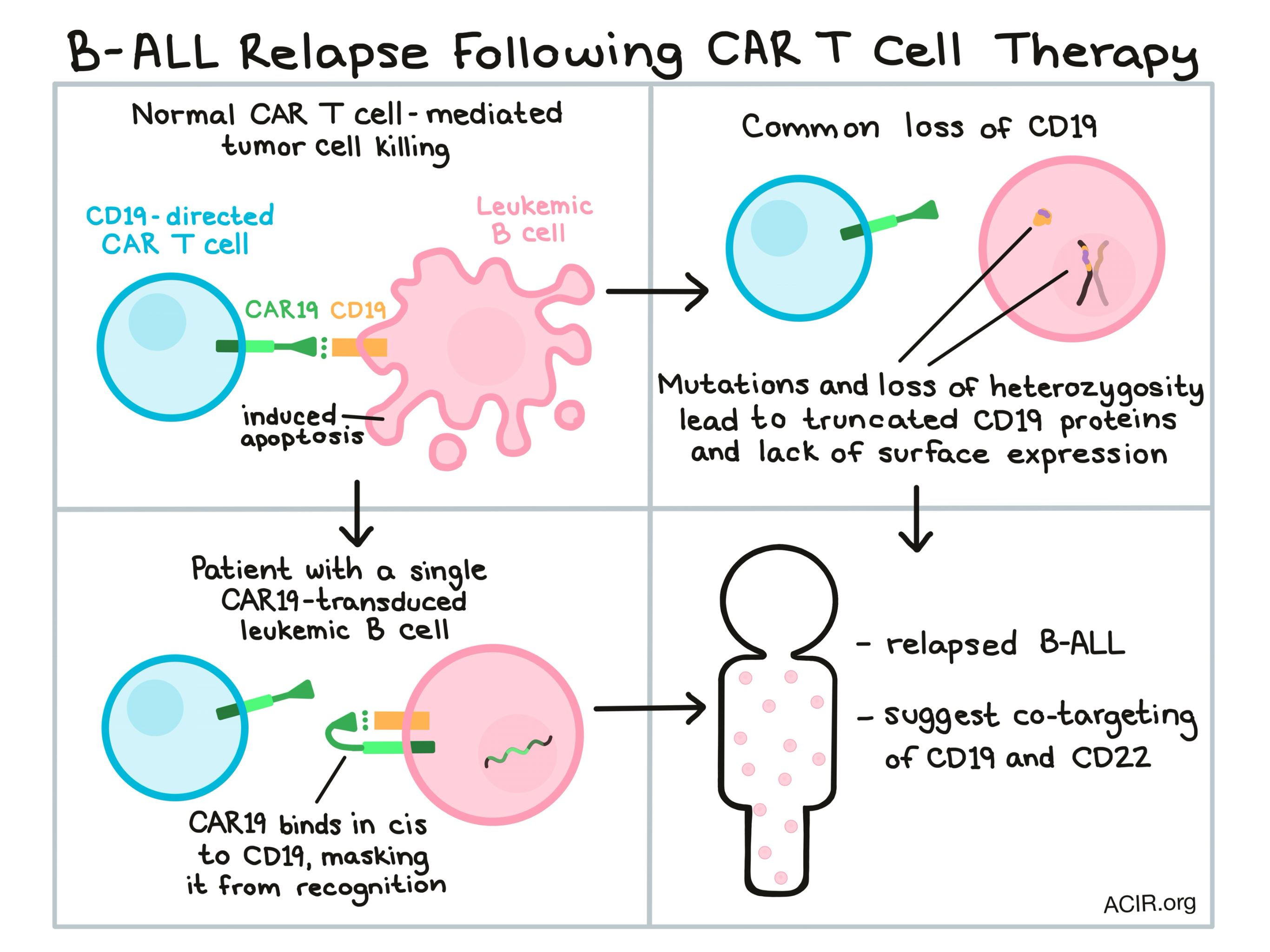 When CAR T cell therapy crashes