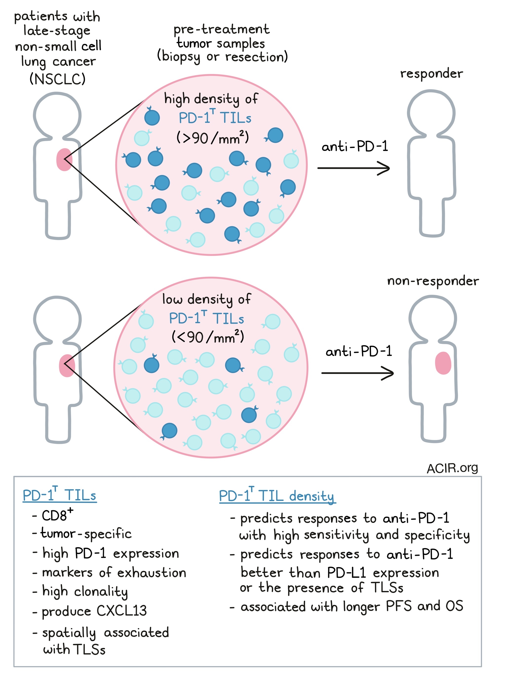 PD-1-high TILs: a predictive biomarker for ICB in lung cancer