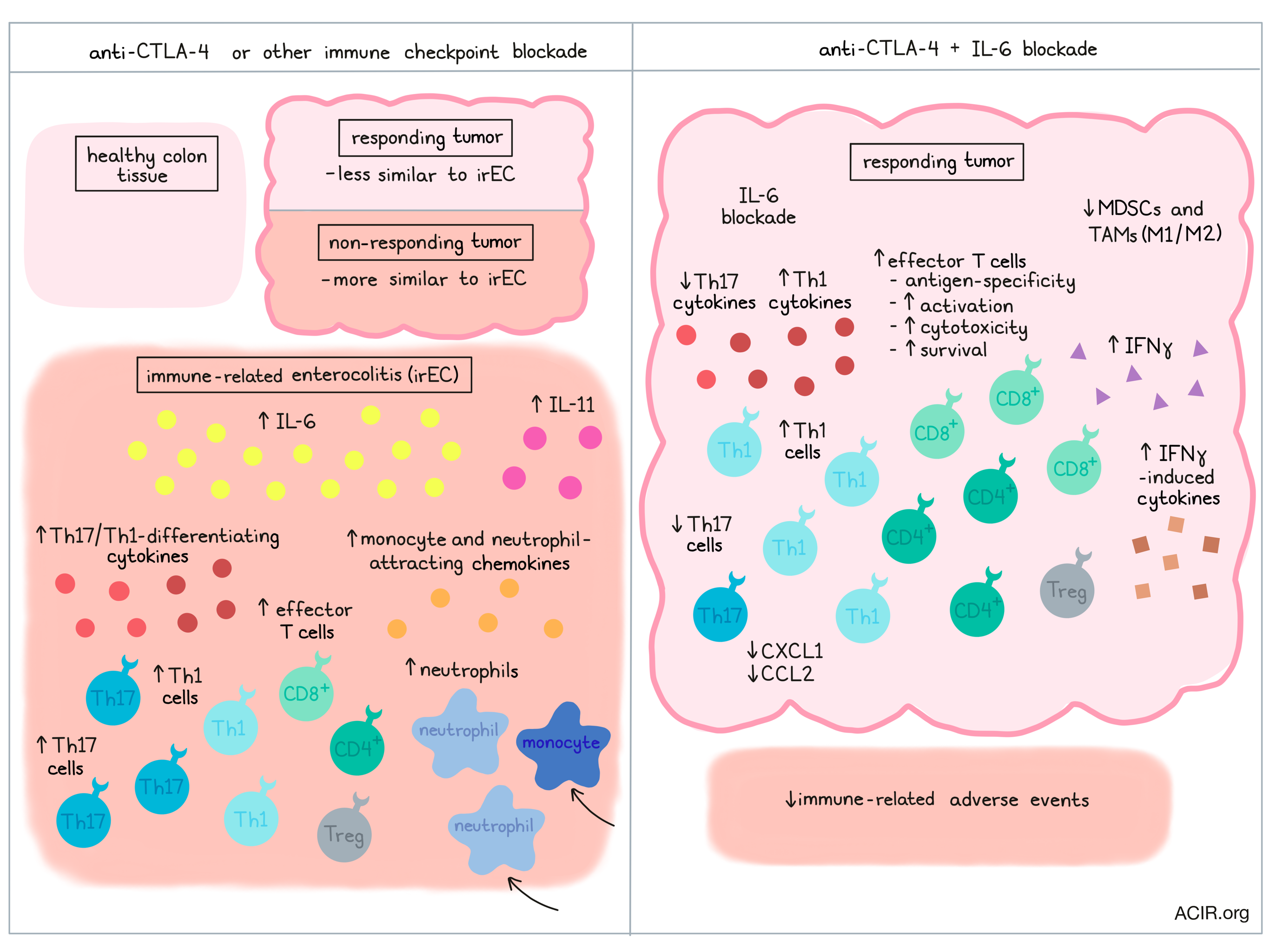 CTLA4 as Immunological Checkpoint in the Development of Multiple