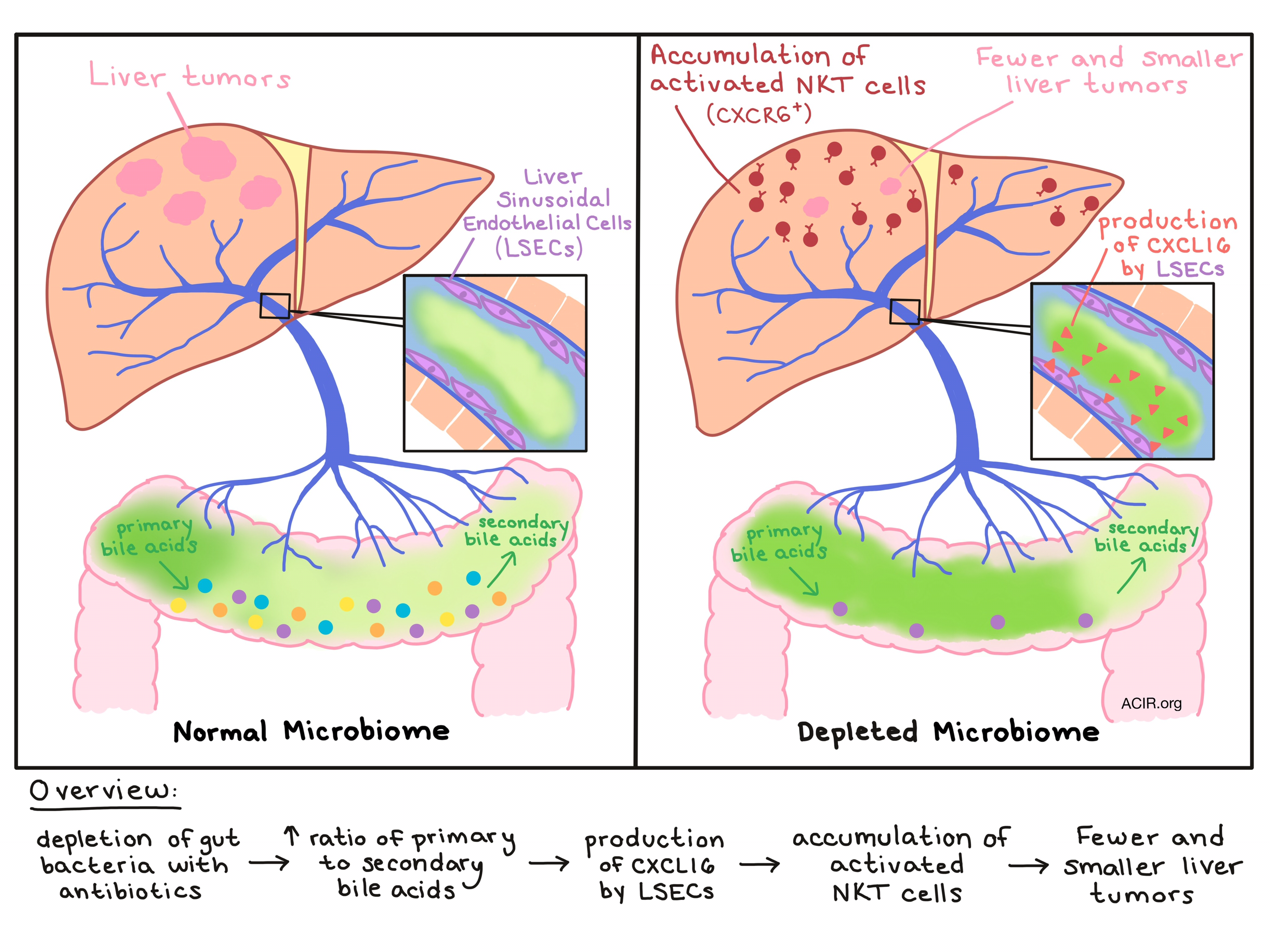 liver-cancer-immunity-and-the-microbiome-connecting-the-dots