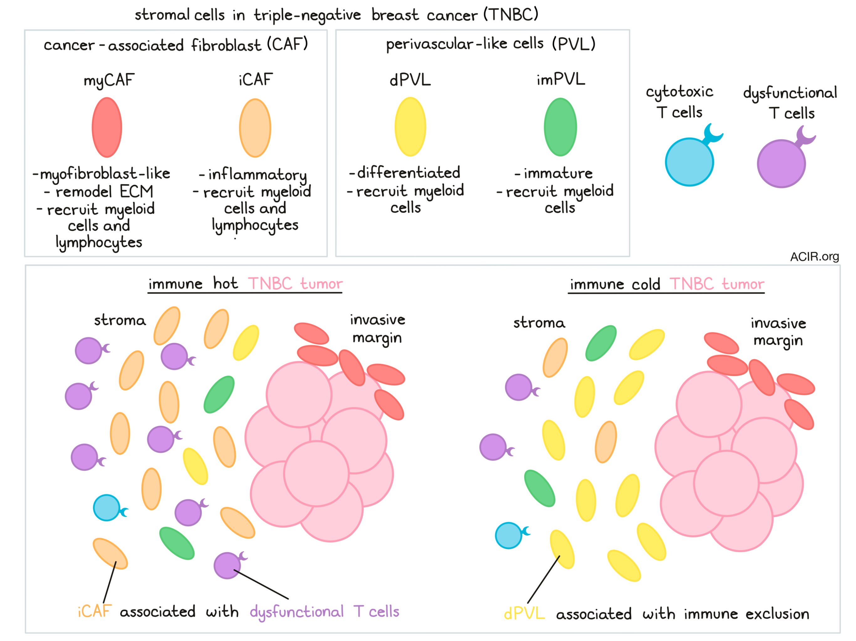 Stromal cells affect immune infiltrate in triplenegative